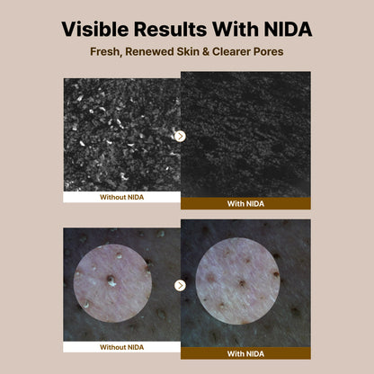 Nida Baby Face Cleanser Bundle (Set of 4)