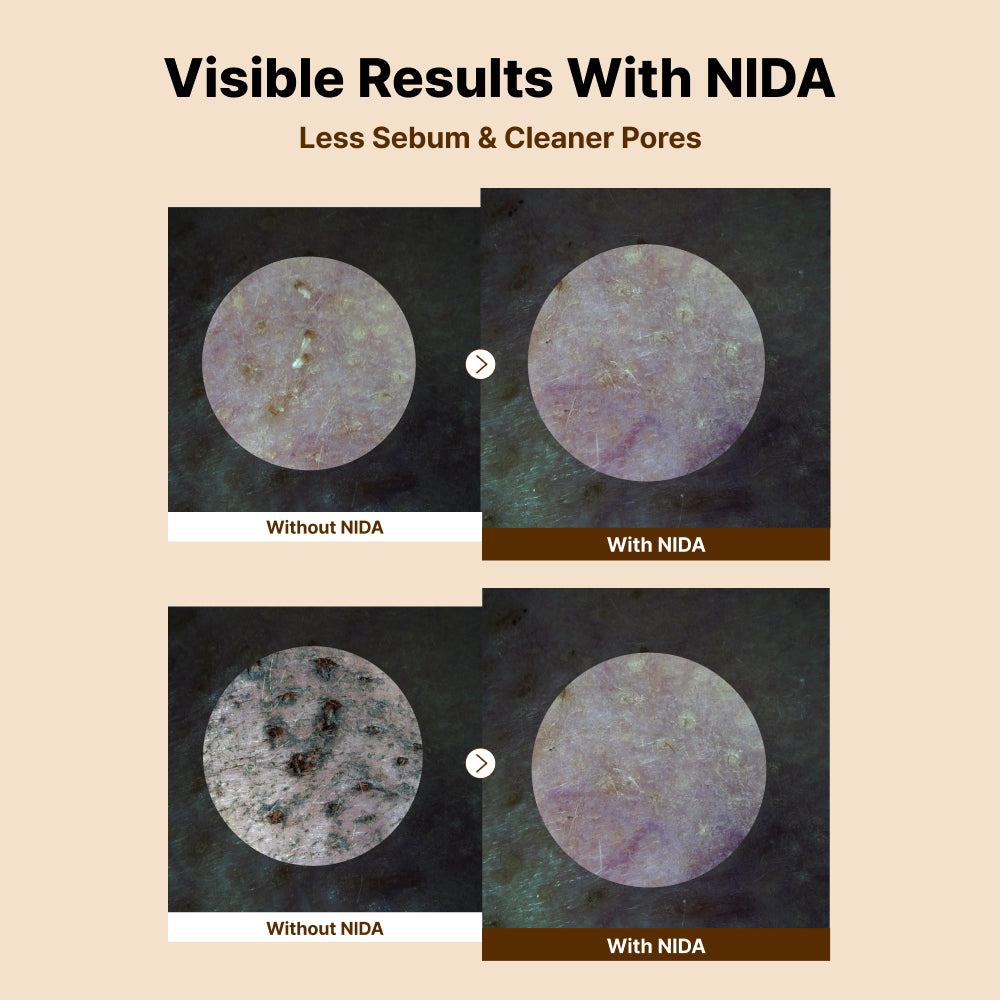 Nida Baby Face Cleanser Bundle (Set of 4)