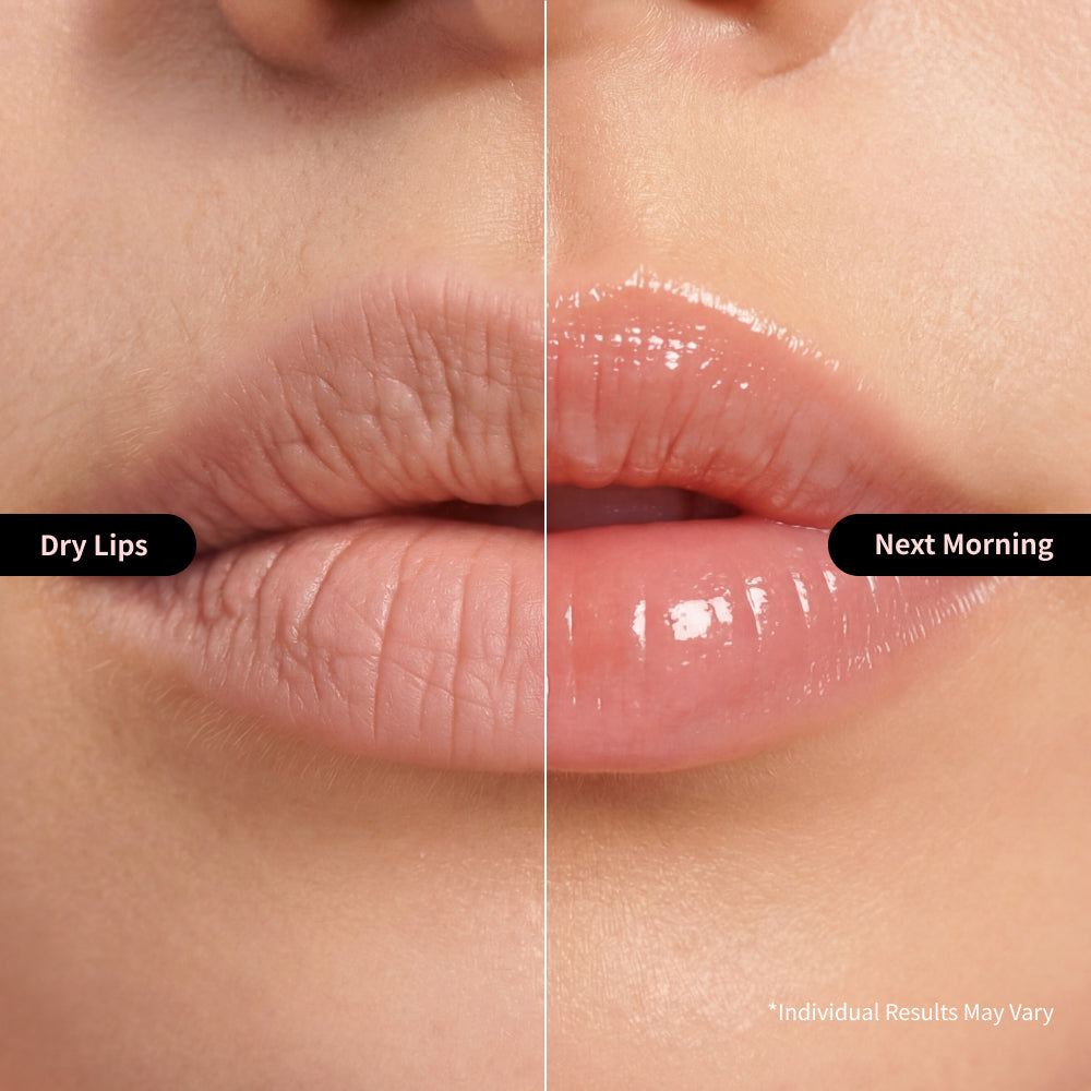 Nida Ultimate Lip Care Set (Lip Serum + Lip Mask)
