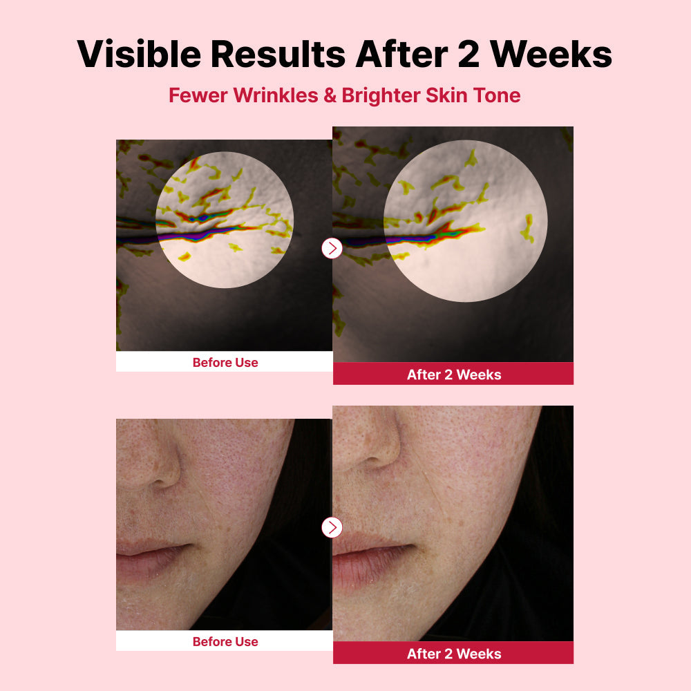 Yam Mucin ABCE Boosting Bundle
