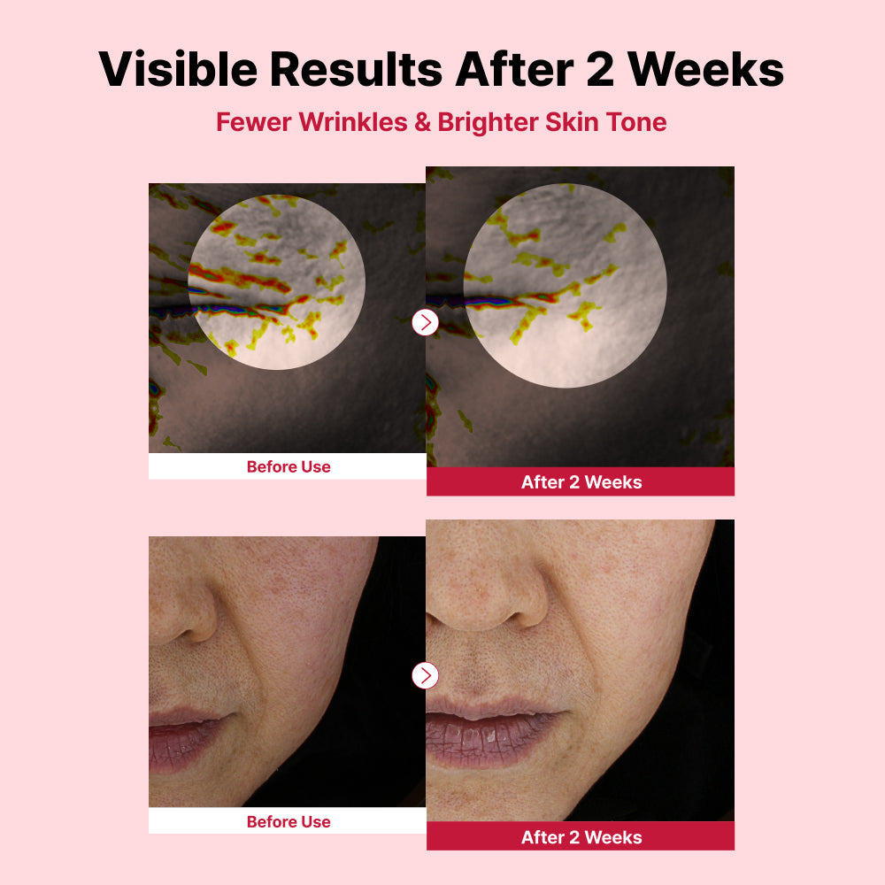 Yam Mucin ABCE Boosting Bundle