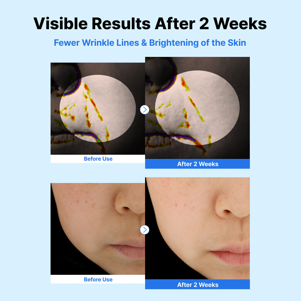 Nida Youthful Glass Skin Bundle