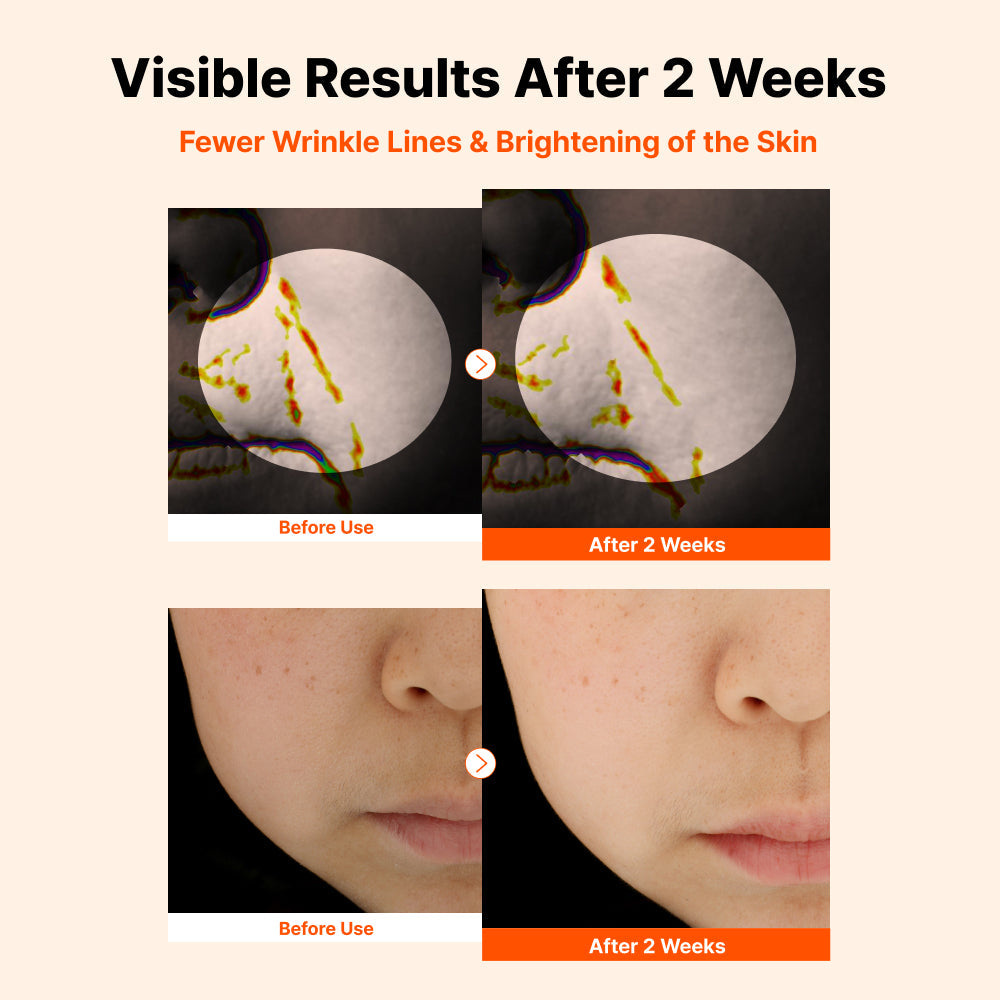 Nida Invisible Fit Sun Duo (Serum & Cream) (Global)